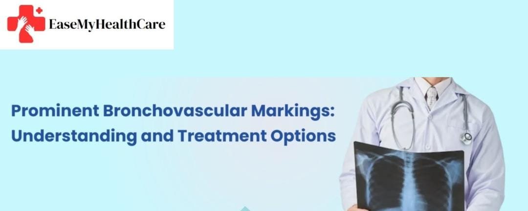 Prominent Bronchovascular Markings