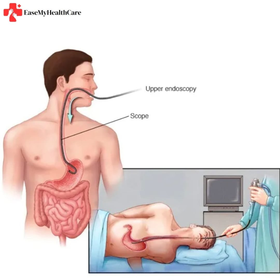 Gallbladder Laparoscopic Surgery
