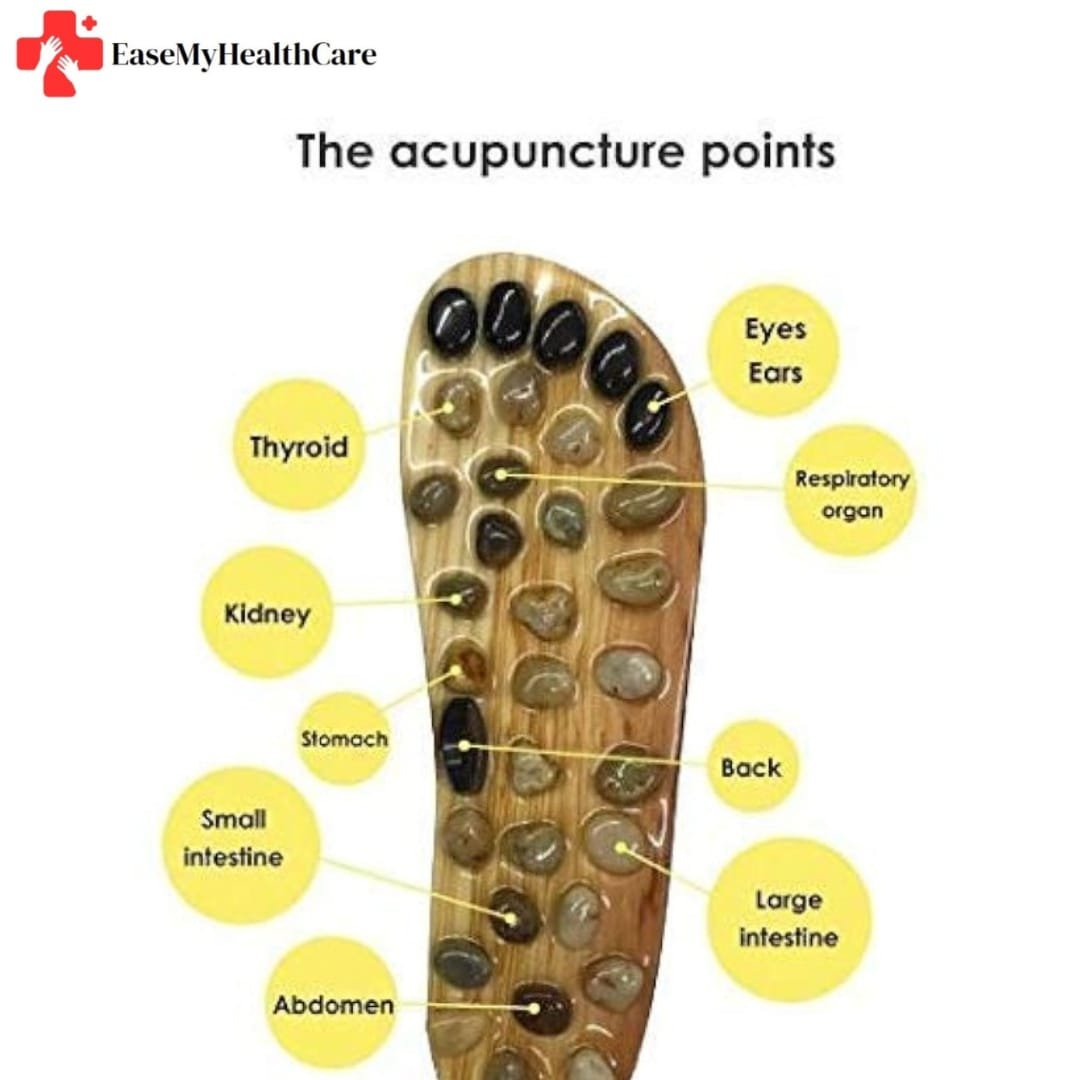 Acupressure Points for Kidney Stone Pain