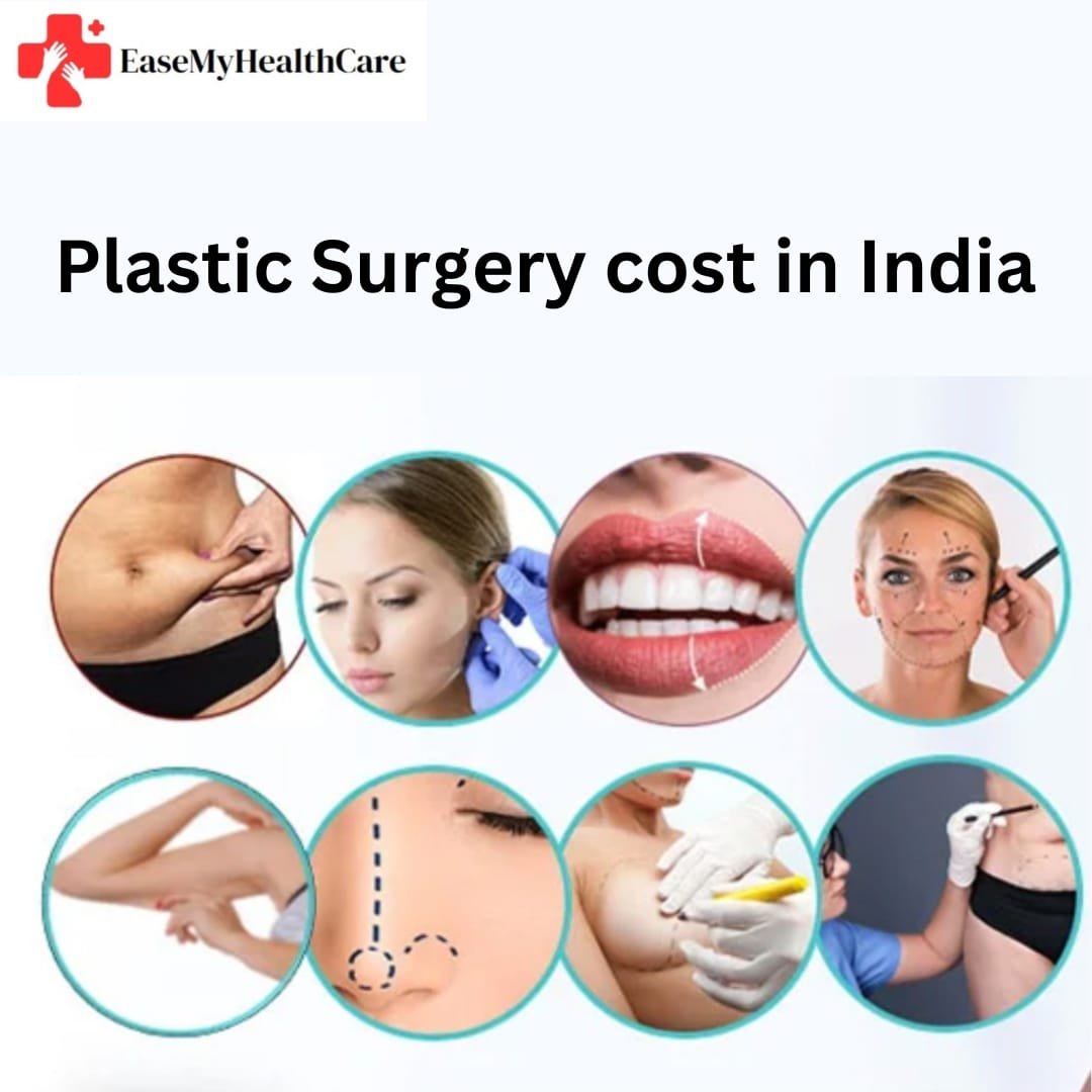 Plastic surgery cost in india