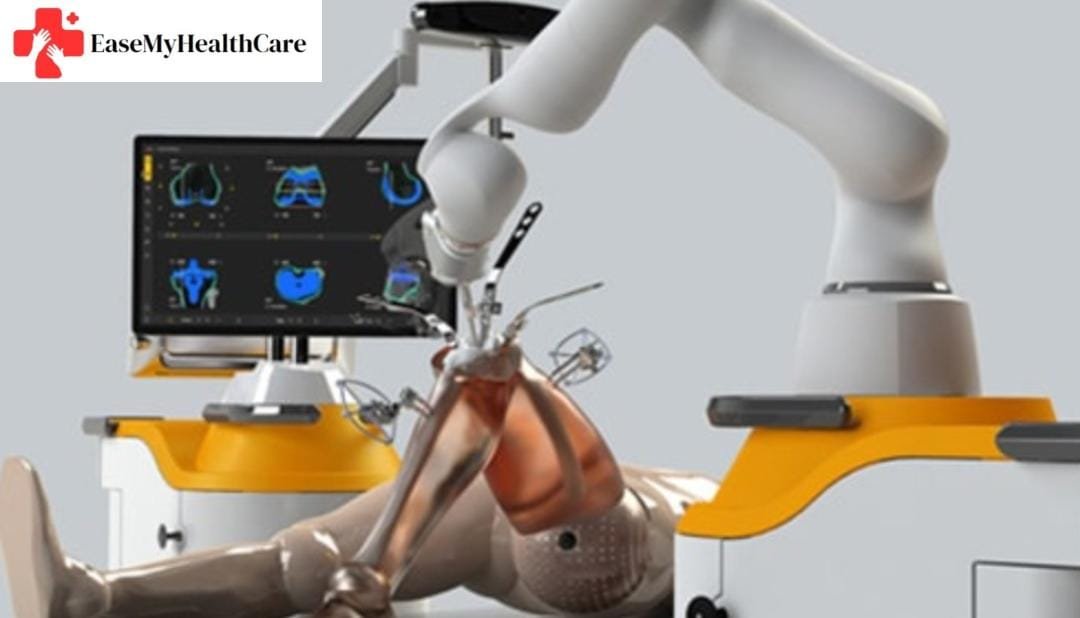 Knee Replacement Surgery in India