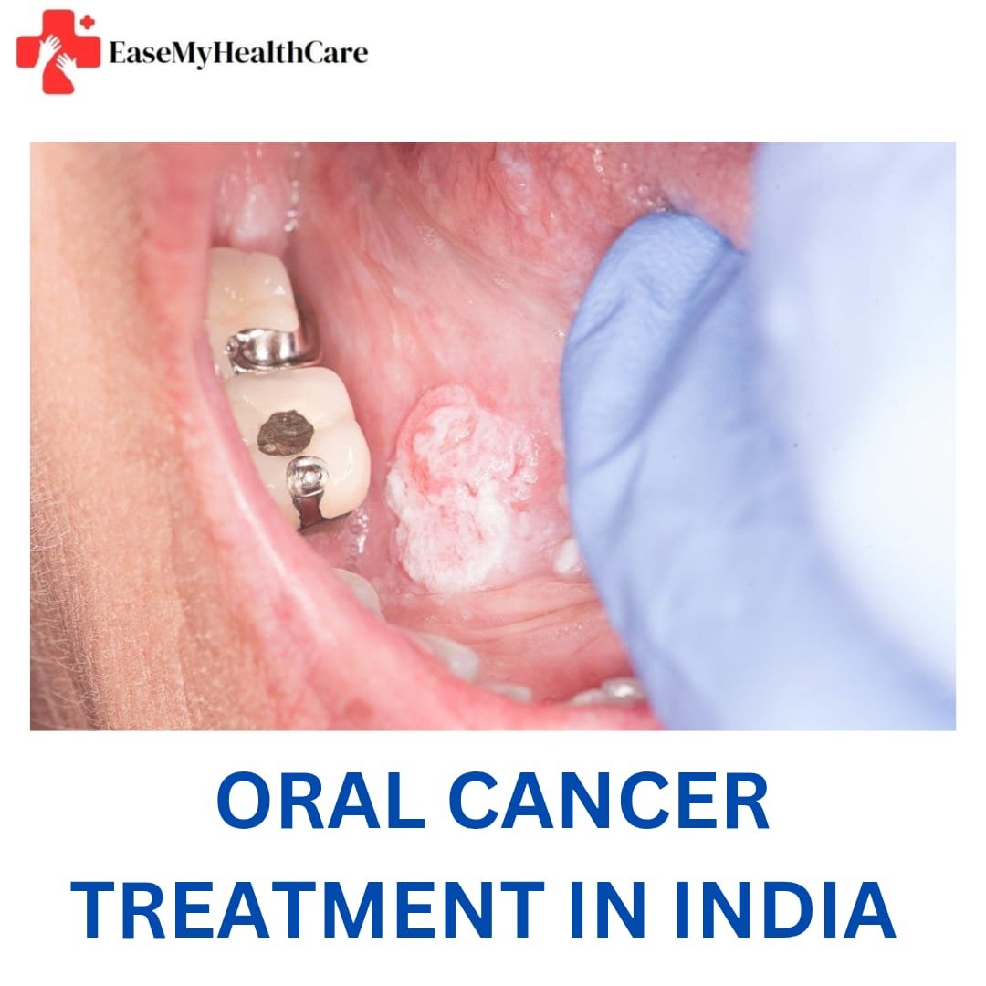 oral cancer treatment cost