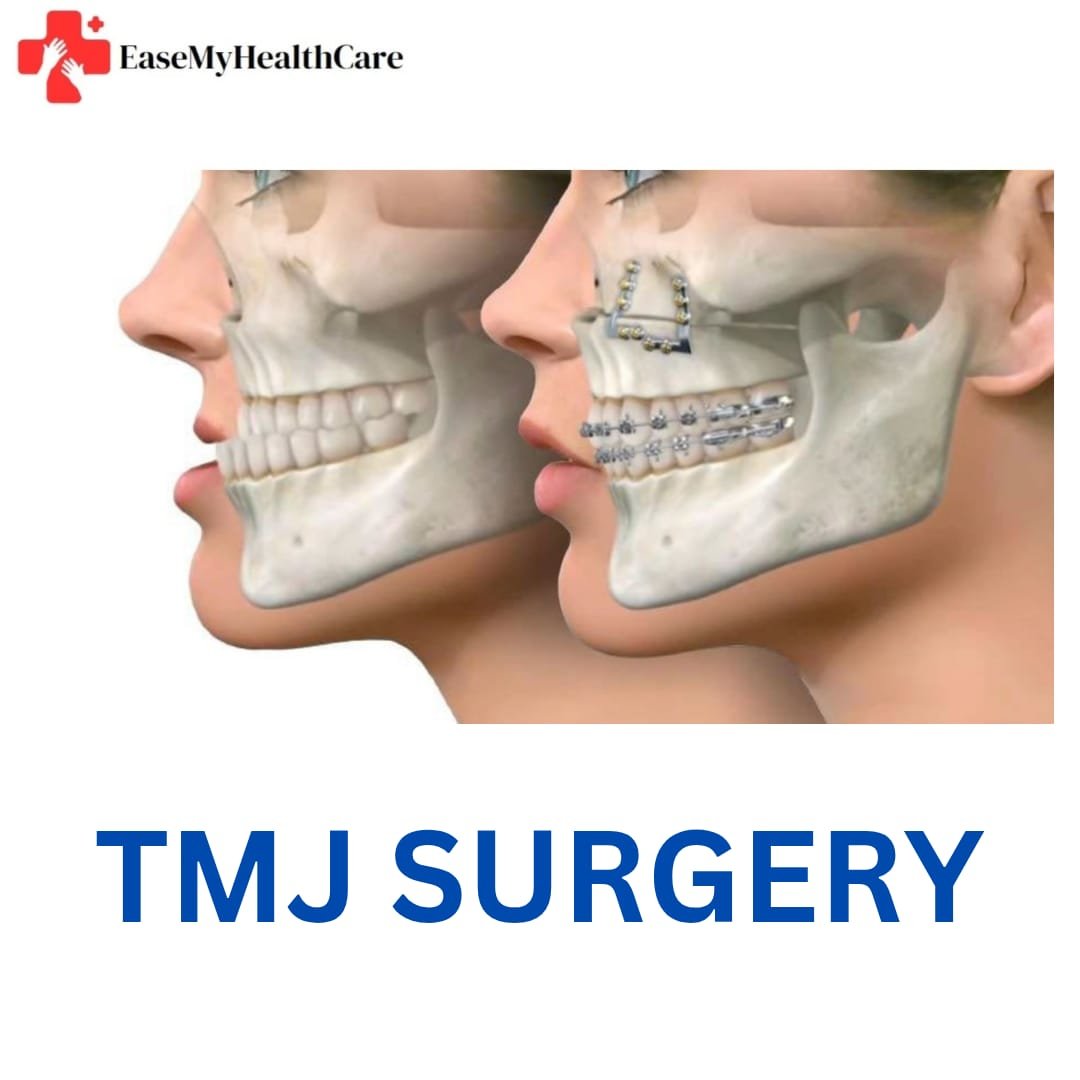 TMJ Surgery Cost