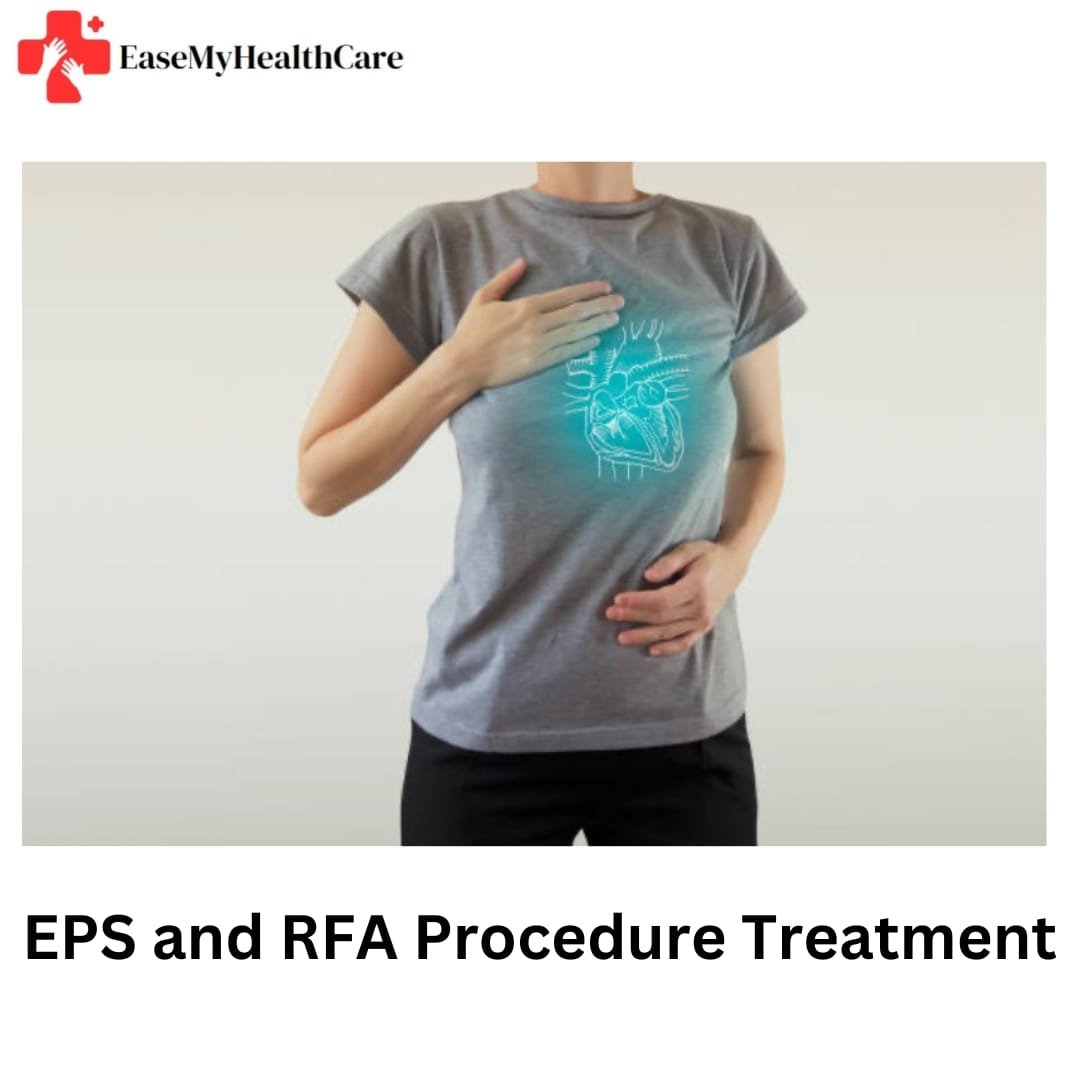 EPS and RFA Procedure Treatment