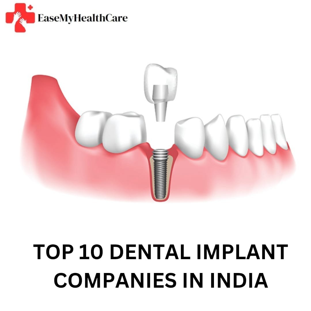 Top 10 Dental Implant Companies in India