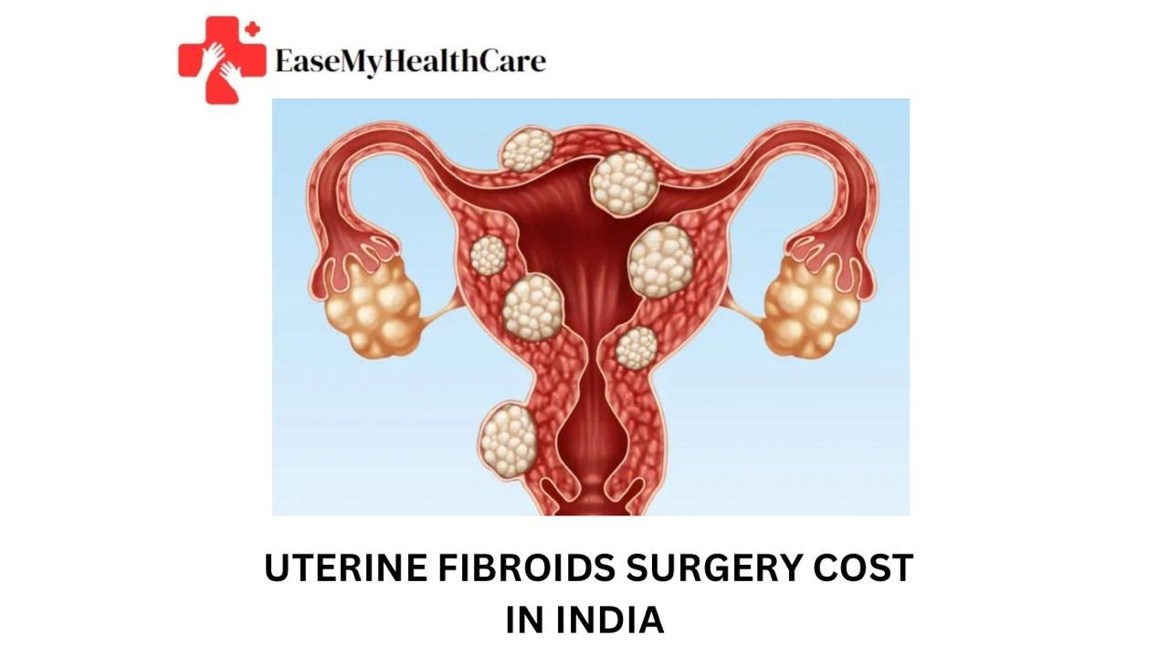 Uterine Fibroids Surgery Cost in India