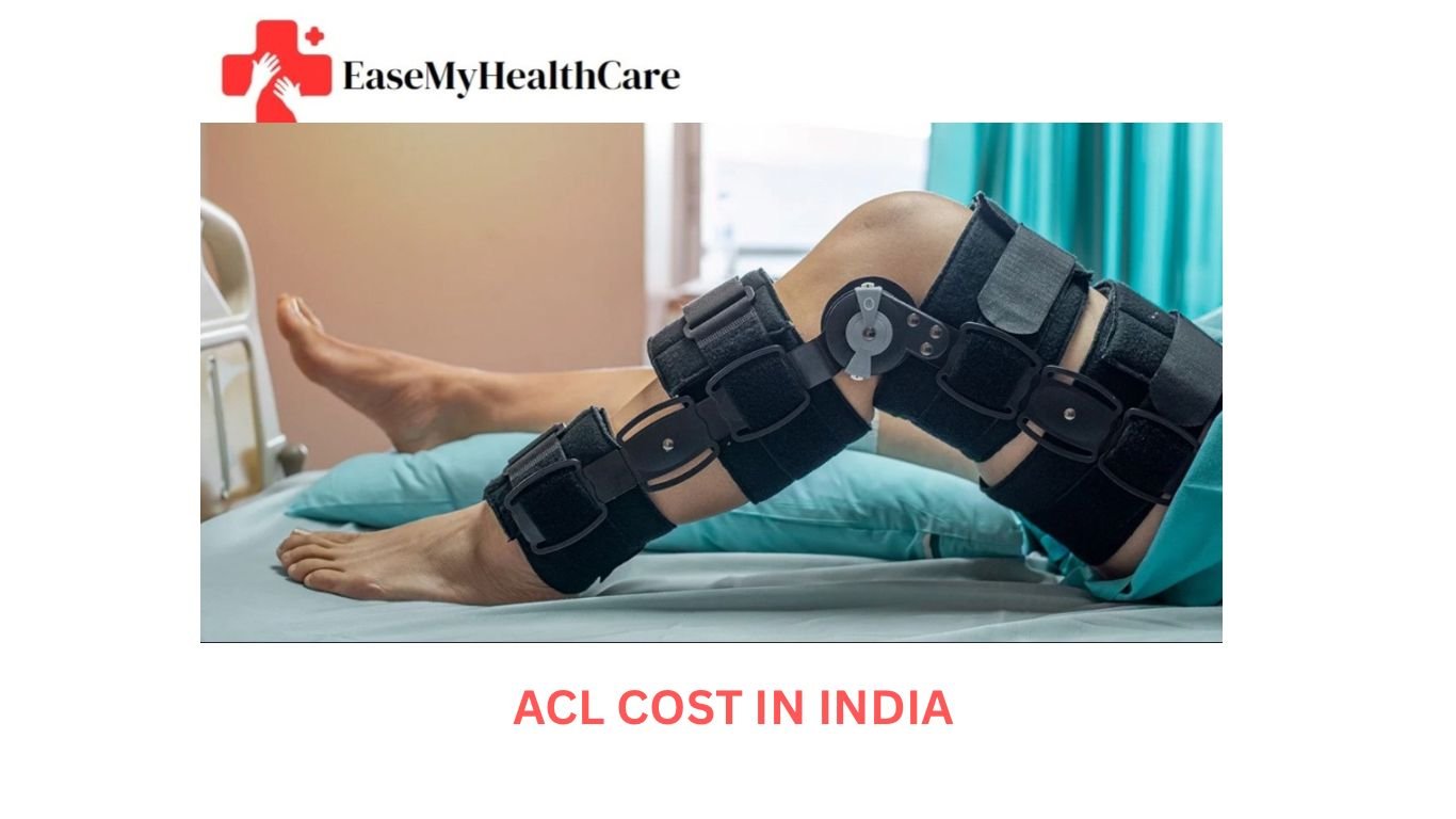 ACL Surgery Cost in India: A Complete Guide for International Patients