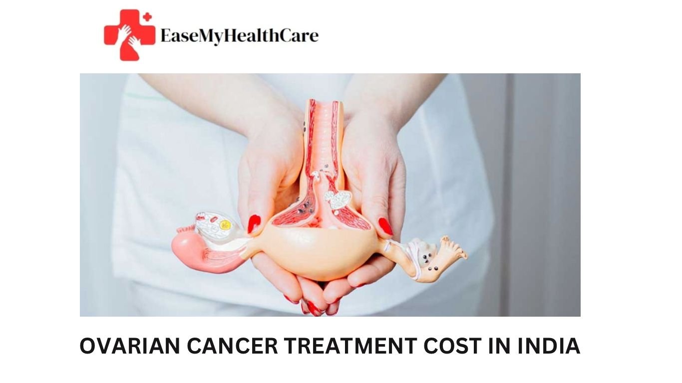 Ovarian Cancer Treatment Cost in India