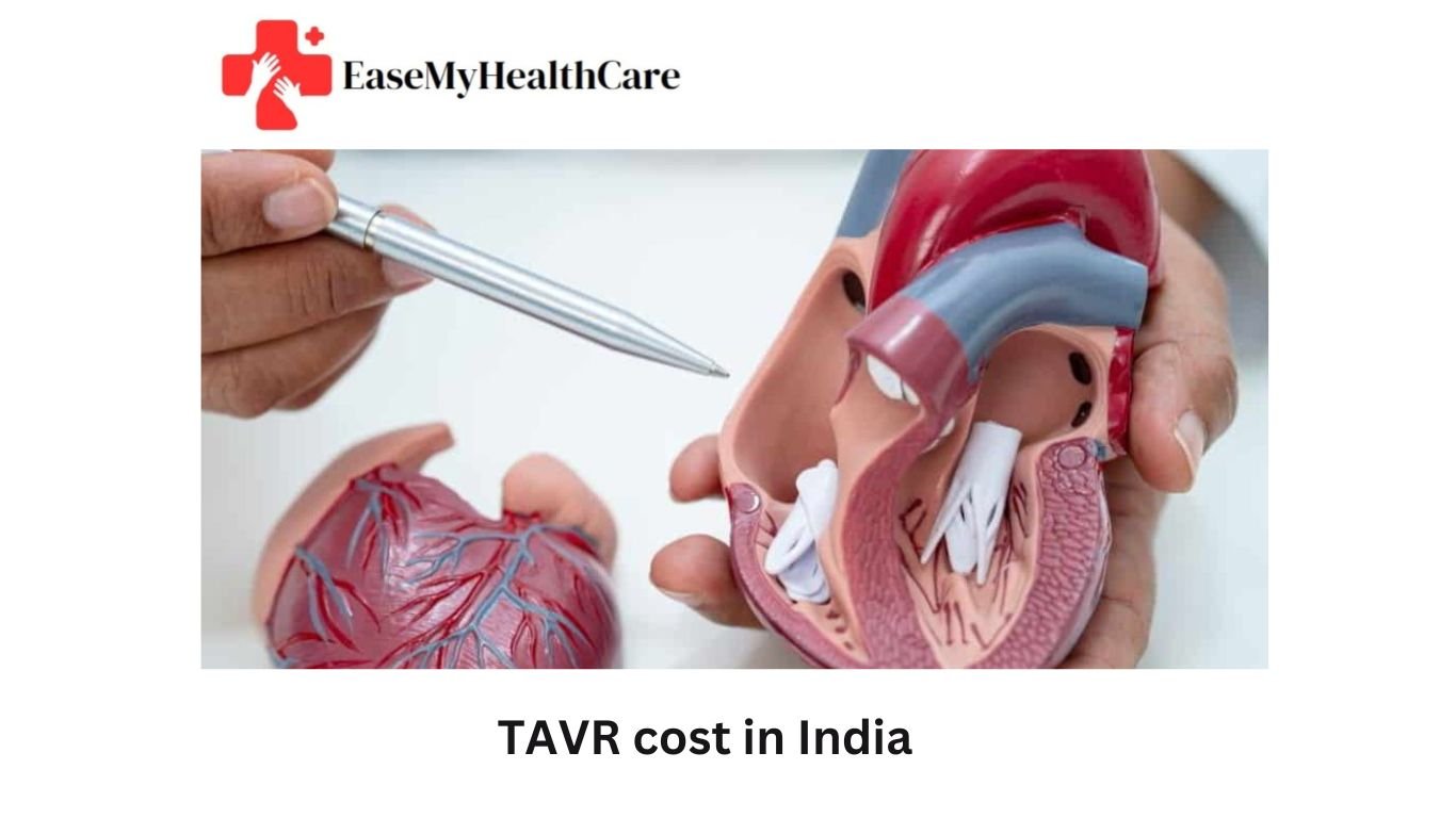 Heart Valve Repair Without Open Surgery: TAVR Cost in India