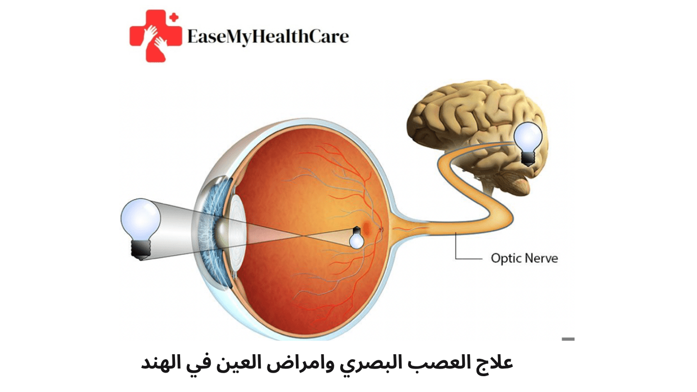 علاج العصب البصري وأمراض العين