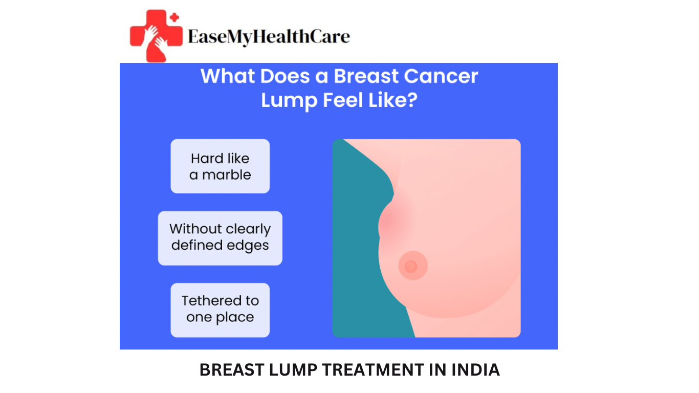 BREAST LUMP TREATMENT IN INDIA