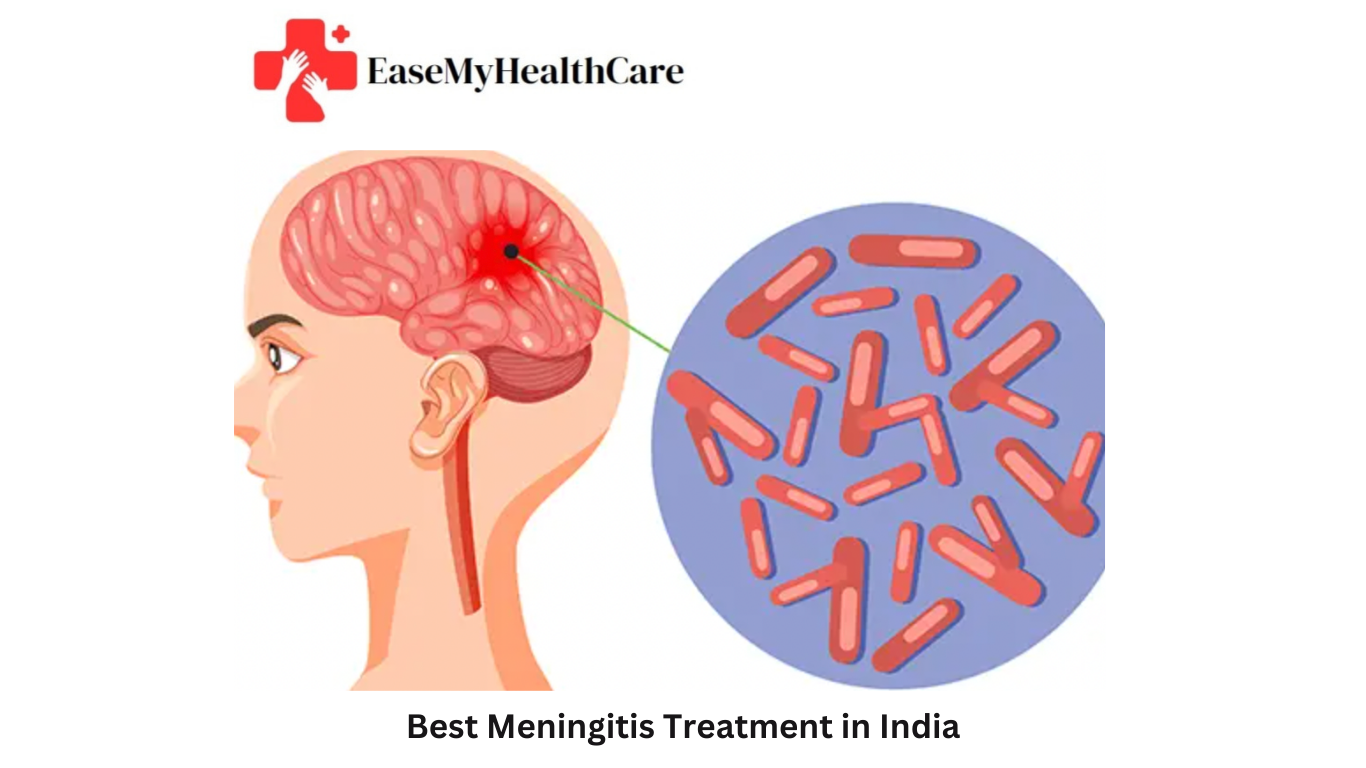 Best Meningitis treatment in India
