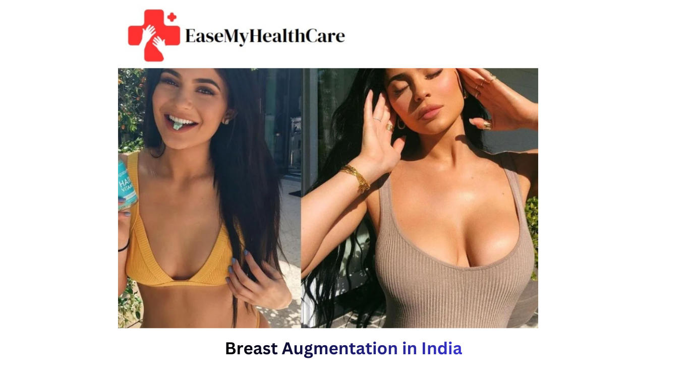 Breast Augmentation in India