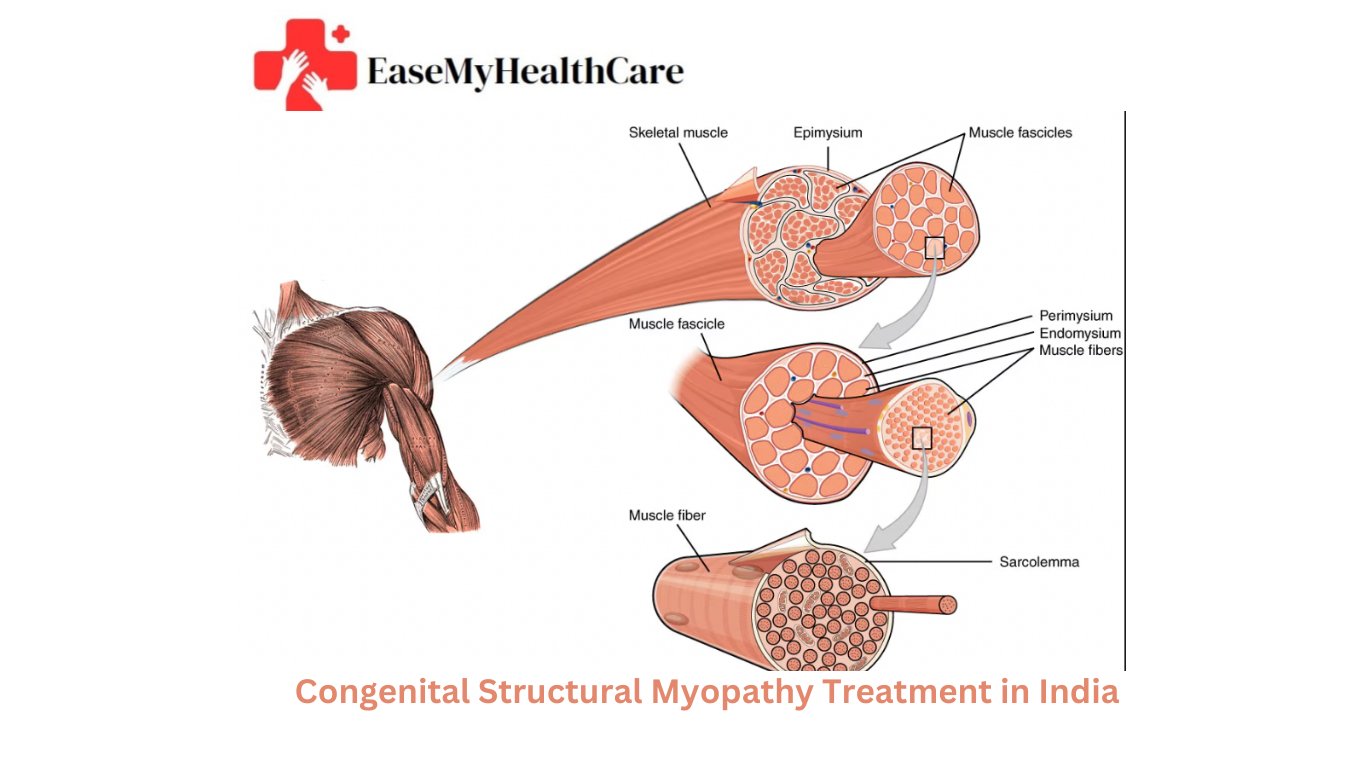 Congenital Structural Myopathy Treatment in India