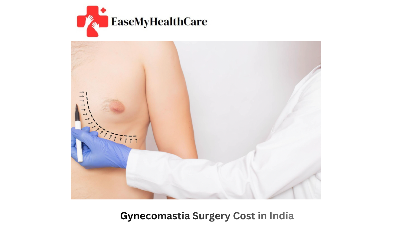 Gynecomastia Surgery Cost in India