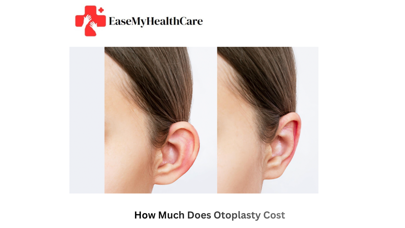 How Much Does Otoplasty Cost?