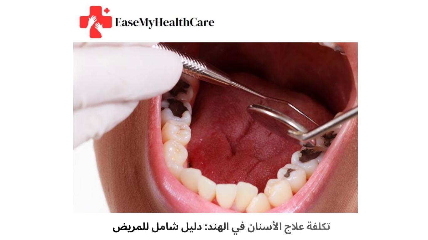 تكلفة علاج الأسنان في الهند