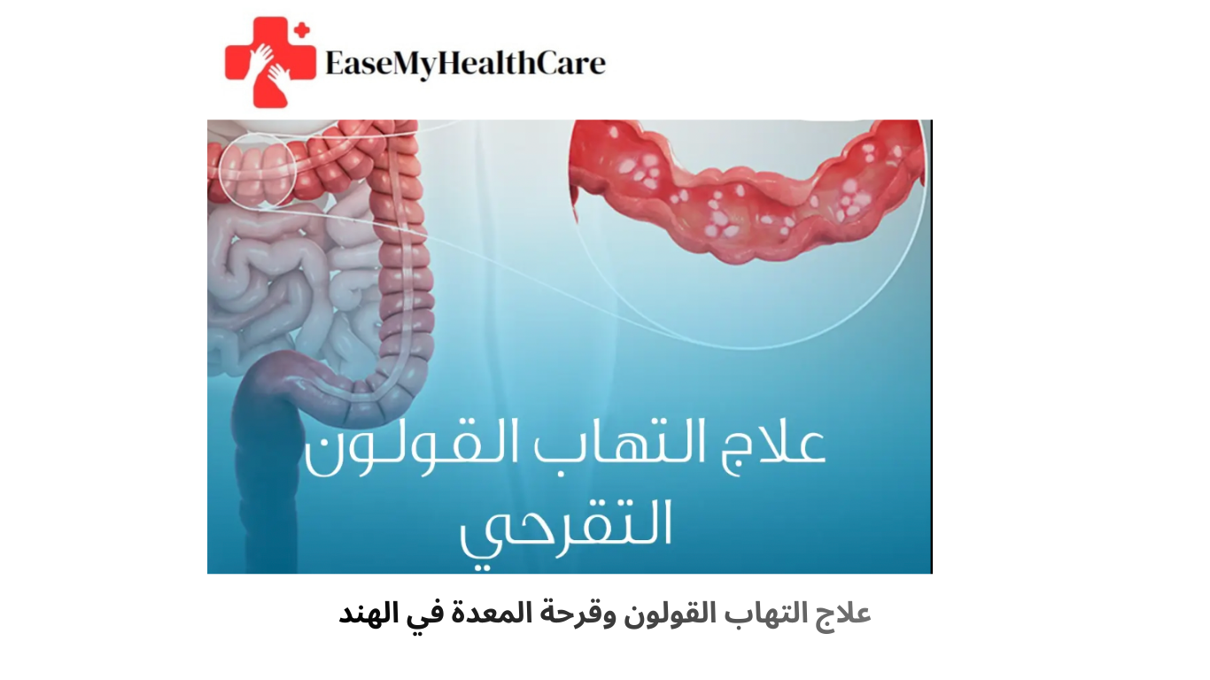 علاج التهاب القولون وقرحة المعدة في الهند