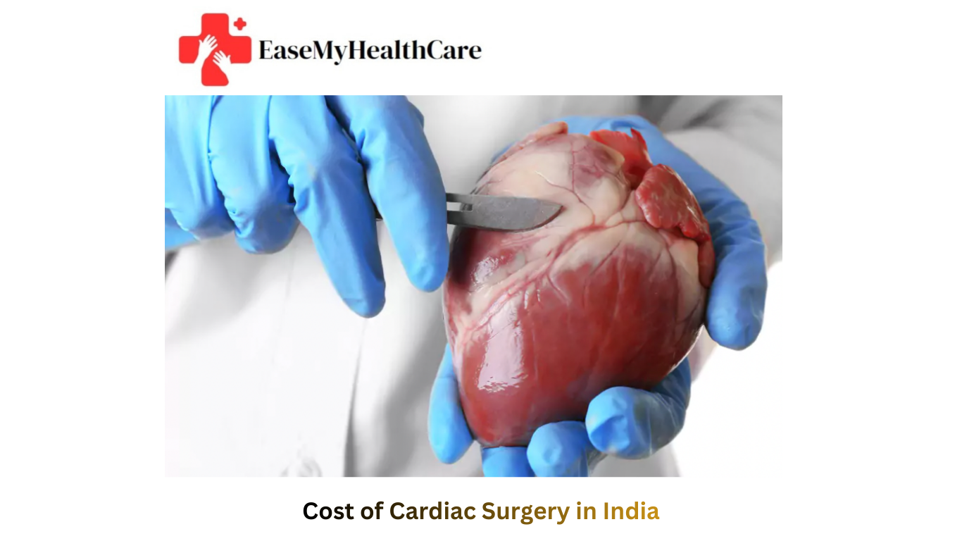 Cost of Cardiac Surgery in India