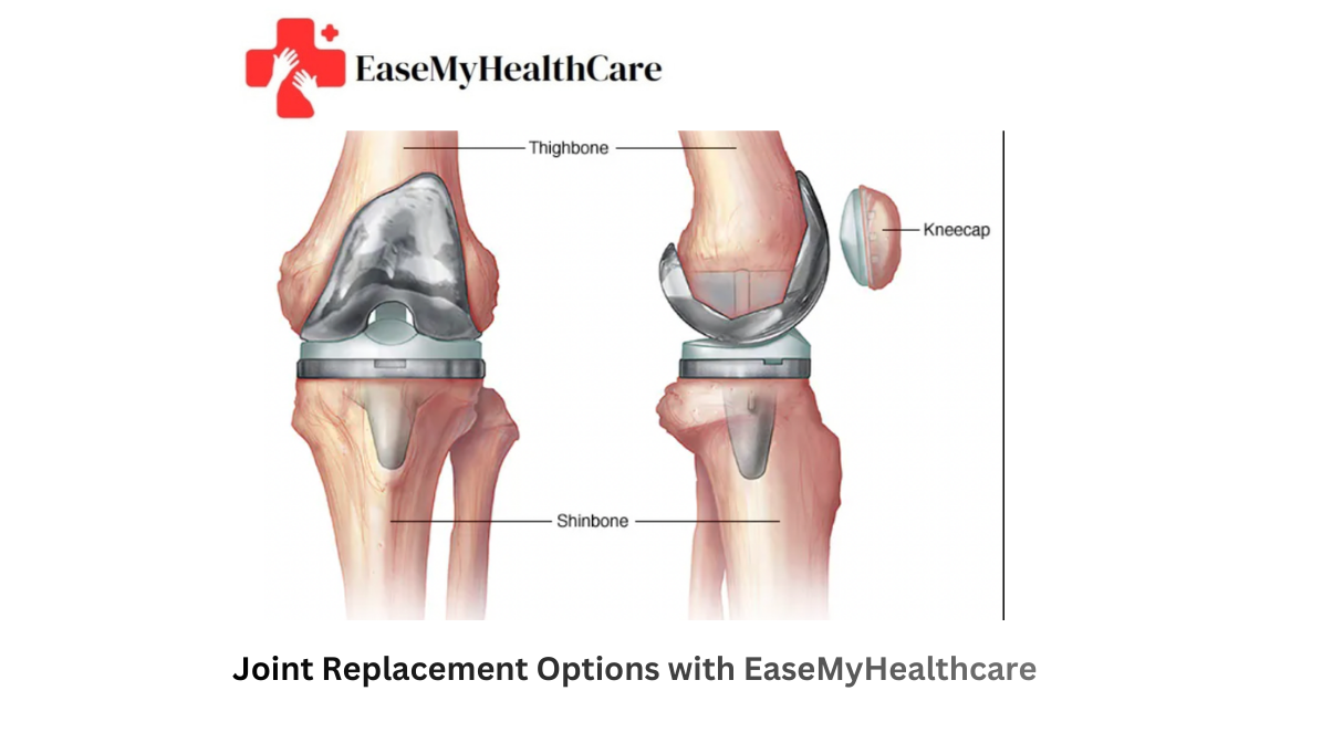 Affordable vs. Premium: Joint Replacement Options with EaseMyHealthcare