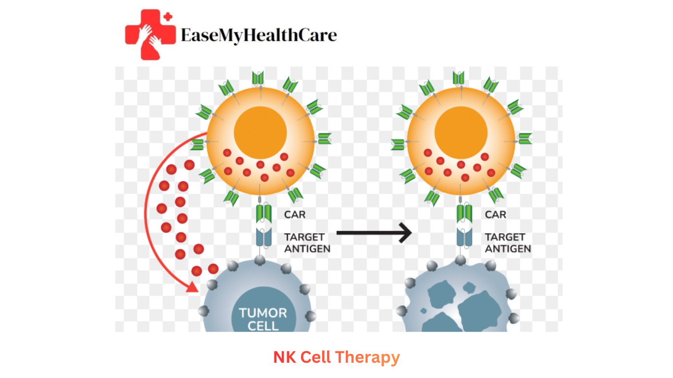 NK Cell Therapy